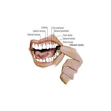 The infection can spread from the tooth root and into the bones which support the tooth. Wisdom Tooth Extraction
