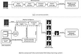 Fully Automated Deep Learning System For Bone Age Assessment