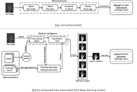 fully automated deep learning system for bone age assessment