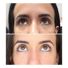 Vanessa Cichon, AGACNP, FNP