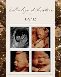 Image result for tbn:T5UajvfpShvp6M::www.photoslinks.com/index.php%3Foption%3Dcom_joomgallery%26func%3Dwatermark%26catid%3D4%26id%3D23%26Itemid%3D2