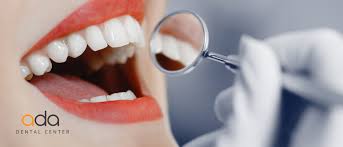 Prin periajul dintilor se indeparteaza particulele cu care se hranesc bacteriile si se improspateaza respiratia. Decembrie 2019 Ada Dental Center