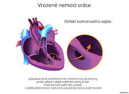 Příčiny, příznaky u dětí, léčba. Plicni Hypertenze Mkn