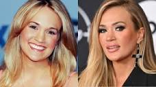 How Carrie Underwood's Face Has Healed Since Her Accident - Heavy.com
