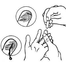 Image result for Capillary Puncture