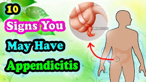 We did not find results for: Don T Ignore These Early Symptoms Of Appendicitis Appendicitis Symptoms Symptoms Signs