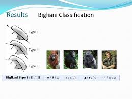 Classe bigliani (it) guardacoste classe bigliani, classe bigliani (guardacoste) (it). Jd Craik R Malina V Ramasamay Nj Little Subacromial Impingement Rotator Cuff Tears 44 To 65 Of All Shoulder Complaints Two Main Theories Mechanical Ppt Download