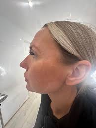 MY NAME IS NATALIE CONNELLY I AM A ADVANCED AESTHETIC PRACTITIONER AND  EDUCATOR. I OFFER A RANGE OF TRAINING COURSES SUCH AS PATHWAY,  DERMAPLANING, MICRONEEDLING, DERMAL FILLERS, ANTI WRINKLE INJECTION, B12,  SKIN