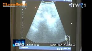 Va propunem sa aflati care sunt principalele cauze ale intarzierii menstruatiei: Intarzierea Menstruatiei Ginecologie Laurusmedical Youtube