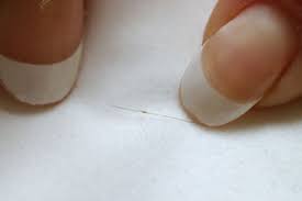 Image result for lice vs dandruff