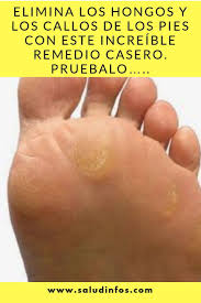 En uncomo te damos consejos y remedios concretos sobre cómo eliminar a continuación, vamos a descubrirte algunos de los mejores remedios caseros para los hongos de los pies gracias a los que podrás recuperar. Elimina Los Hongos Y Los Callos De Los Pies Con Este Increible Remedio Casero Pruebalo Elimina Hongos Callos Keto Diet For Beginners Remedies Psoriasis