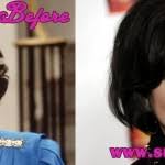 Her appearance looks weird after having some beauty surgeries done. Delta Burke Before Surgery Young Surgerystars