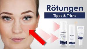 Vorbeugen ist besser als heilen, also natürliche heilmittel sind empfohlen wenn sie wirklich ihre haut gut aussehen wollen. Faq Unsere Antworten Mit Tipps Und Produktempfehlungen Dermasence