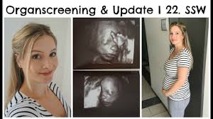 Schwangerschaftsupdate I Organscreening I 22 Ssw Youtube