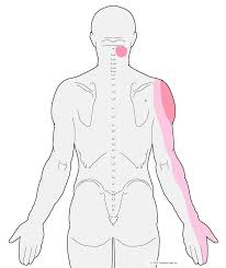 Pin On Health
