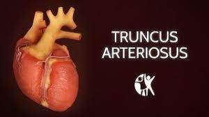 Truncus Arteriosus Youtube