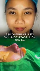 Level up your beauty goals with the power of the group! 💸✨ The Retoke  Paluwagan makes your dream procedure affordable and achievable. Secure your  spot and start saving smarter today! Link in bio for ...