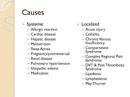 Image result for Localized Edema