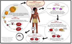Malaria definition malaria is a serious infectious disease spread by certain mosquitoes. Malaria Infection Course Complications Diagnosis Transasia Bio Medicals