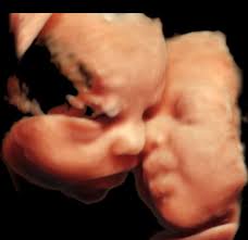 Dott. Salvatore Foresta, ginecologo