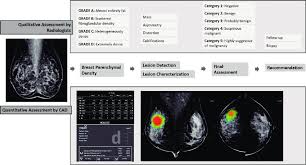 Image result for Mammogram Interpretation