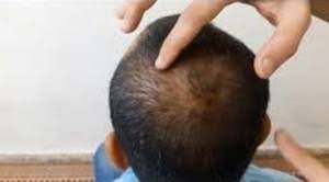 كيف تصنع تشكيلة معجنات مدهشة زاكي