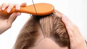 Dans le cuir chevelu, 95% des cheveux sont en phase de régénération, qui dure plusieurs années, alors que le catagène et le télogène ne dure que quelques mois. Ø±Ø¬Ù„ Ø¹ØµØ§Ø¨Ø© Ø³Ù…ÙÙˆÙ†ÙŠØ© Ù…Ù‚Øµ Cause Perte De Cheveux Femme Kissruneggs Com