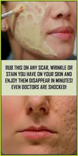 Rub This On Any Scar Wrinkle Or Stain You Have On Your Skin And Watch Them Disappear In Minutes Even Doctors Are Shocked Wellness Days In 2020 Skin Scar Your Skin