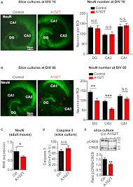 The Tau/A152T mutation, a risk factor for frontotemporal‐spectrum  disorders, leads to NR2B receptor‐mediated excitotoxicity
