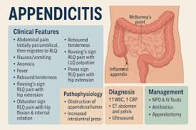 Image result for Appendicitis
