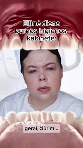 Nijolepareigyte Nepatogus Klausimai