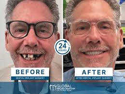 Global Implant Dentistry