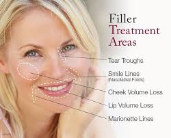 Find your youthful look again with Dermal Fillers