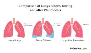 Image result for Pleiotaxis