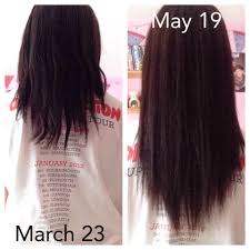 As a new mom and a dermatologist, i noticed my hair wasn't as full as it was in the past. Emily Jayne Hair Growth Challenge Are Any Myths True