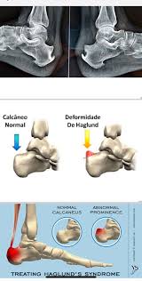 Pin De Fmm Rad En Radiologia Radiologia Imagenologia Medical