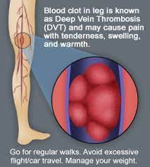 Pin On Fibromyalgia