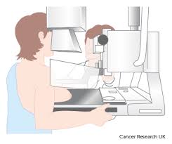 Based on individual choice and factors. Breast Screening Breast Cancer Cancer Research Uk