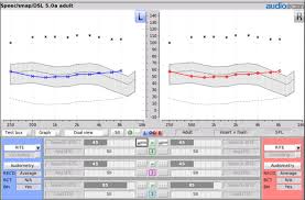 20q using the aided speech intelligibility index in hearing