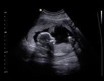 Where can i get a free ultrasound. 88 Ultrasound Free Stock Photos Stockfreeimages