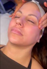 I had the BEST treatment with Shelby Zemenski at VIO Med Spa Toledo, Ohio!  I almost dozed off multiple times. 🤣She did the Linder Health hero peel  and a jelly mask! My skin is hydrated, clear, and my ...