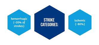 Image result for Stroke Pathophysiology