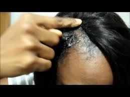 This is where the hair extensions are sewn into your hair. How To Easily Remove Glue In Weave And Sew In Weave Youtube