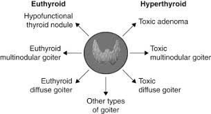 Image result for Multinodular Goiter