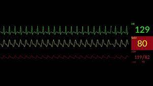 Simulated patient￼ monitor waveforms - YouTube