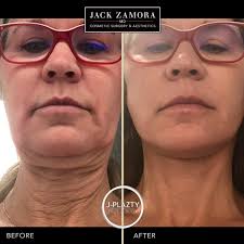 Jack Zamora MD Cosmetic Surgery and Aesthetics