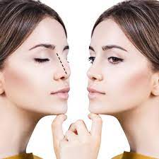 Best San Francisco Rhinoplasty Bay Area Near Me Double Board Certified Plastic Surgeon Sieber Plastic Surgery