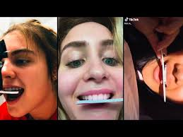 Inside Edition The New Diy Teeth Filing Tik Tok Trend Is A Don T The Super Dentists