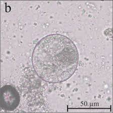 Image result for Balantoides Coli