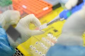 Join facebook to connect with chino corona and others you may know. Chinese University Develops Rapid Test Kit For Coronavirus East Asia News Top Stories The Straits Times